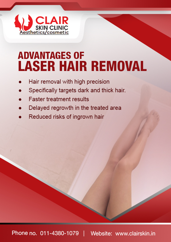Laser hair removal benefits